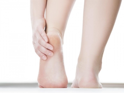 نصائح وحلول لعلاج تشقق القدمين