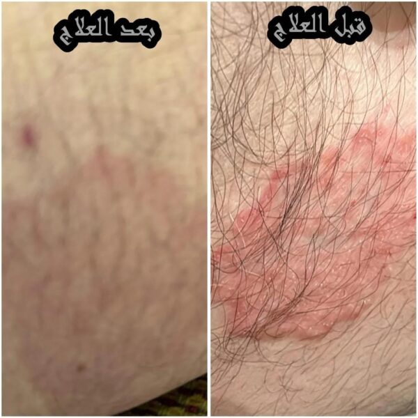 04834aca-880d-44d2-aa57-21fd739ed8ea